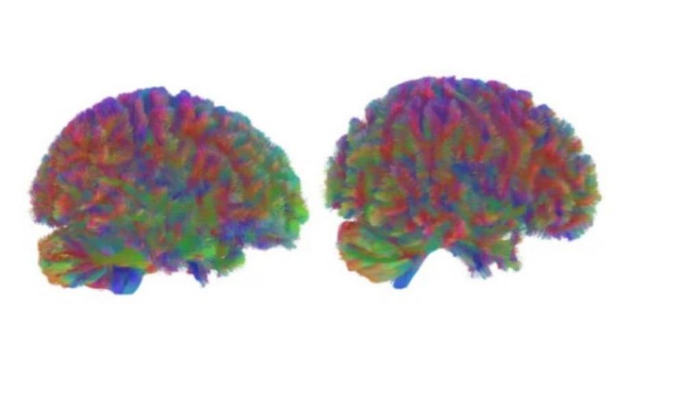 重大发现！人类大脑一生4次关键转折，32岁才真正“成年”11月25日消息，