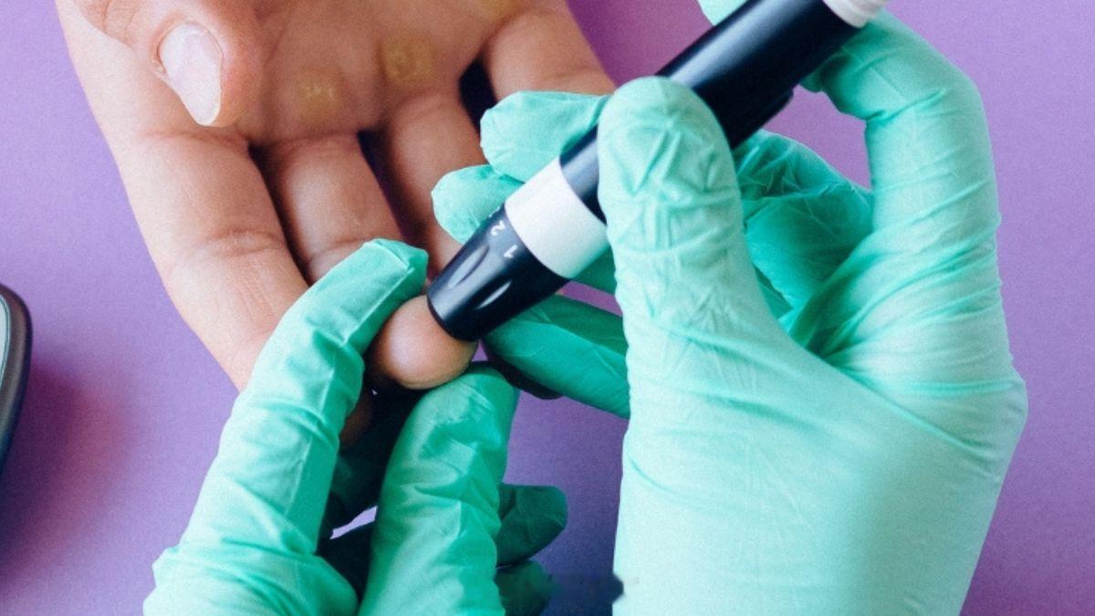 第五型糖尿病列入分类国际糖尿病医学界近期正式确认了一种全新的糖尿病分类，被称为