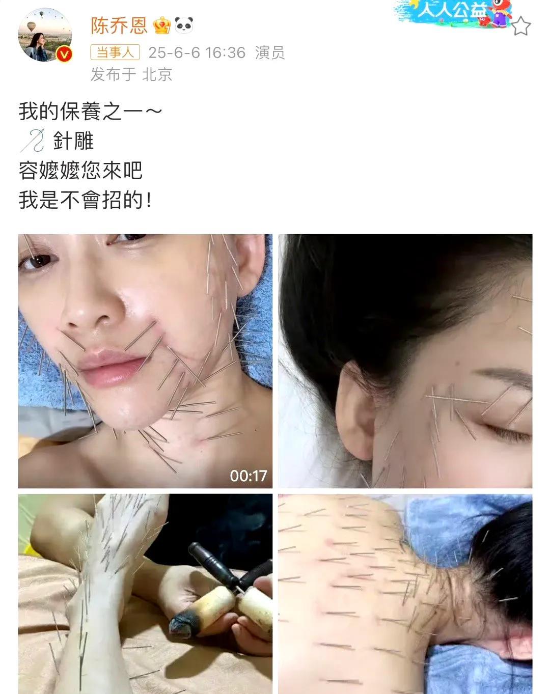 救命！陈乔恩的“全身针雕”保养法太狠了！为了保持冻龄状态，她直接选择全身针雕，听