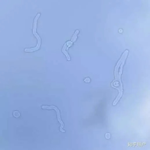 【这些像微生物一样的东西是啥？】当我们在看蓝天等浅色物体时，有时候能看见一些像微
