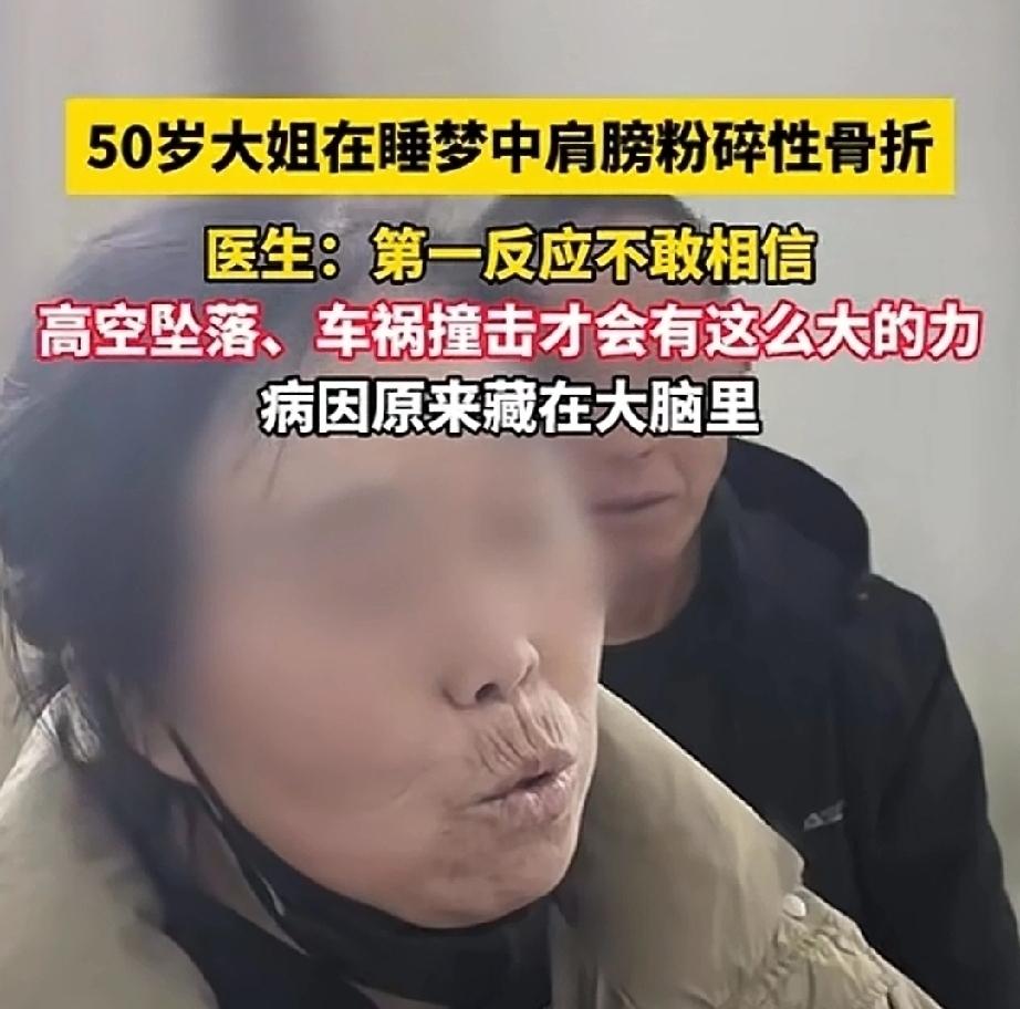 在睡梦中竟然会骨折，这听起来似乎是天方夜谭，但确实是发生了。近日，河南。50岁