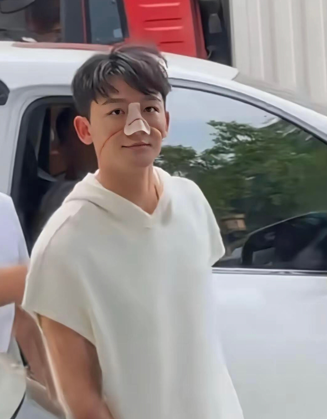 张晚意这是怎么了，鼻子伤的也太严重了吧。也太人心疼了！