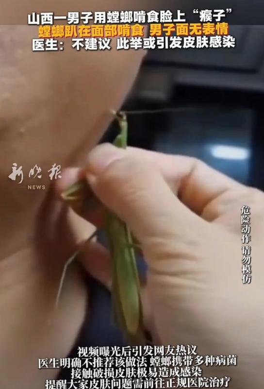 “真是个狠人！”山西，一男子为祛除脸上的“瘊子”，竟让活螳螂在面部生生啃食。让人