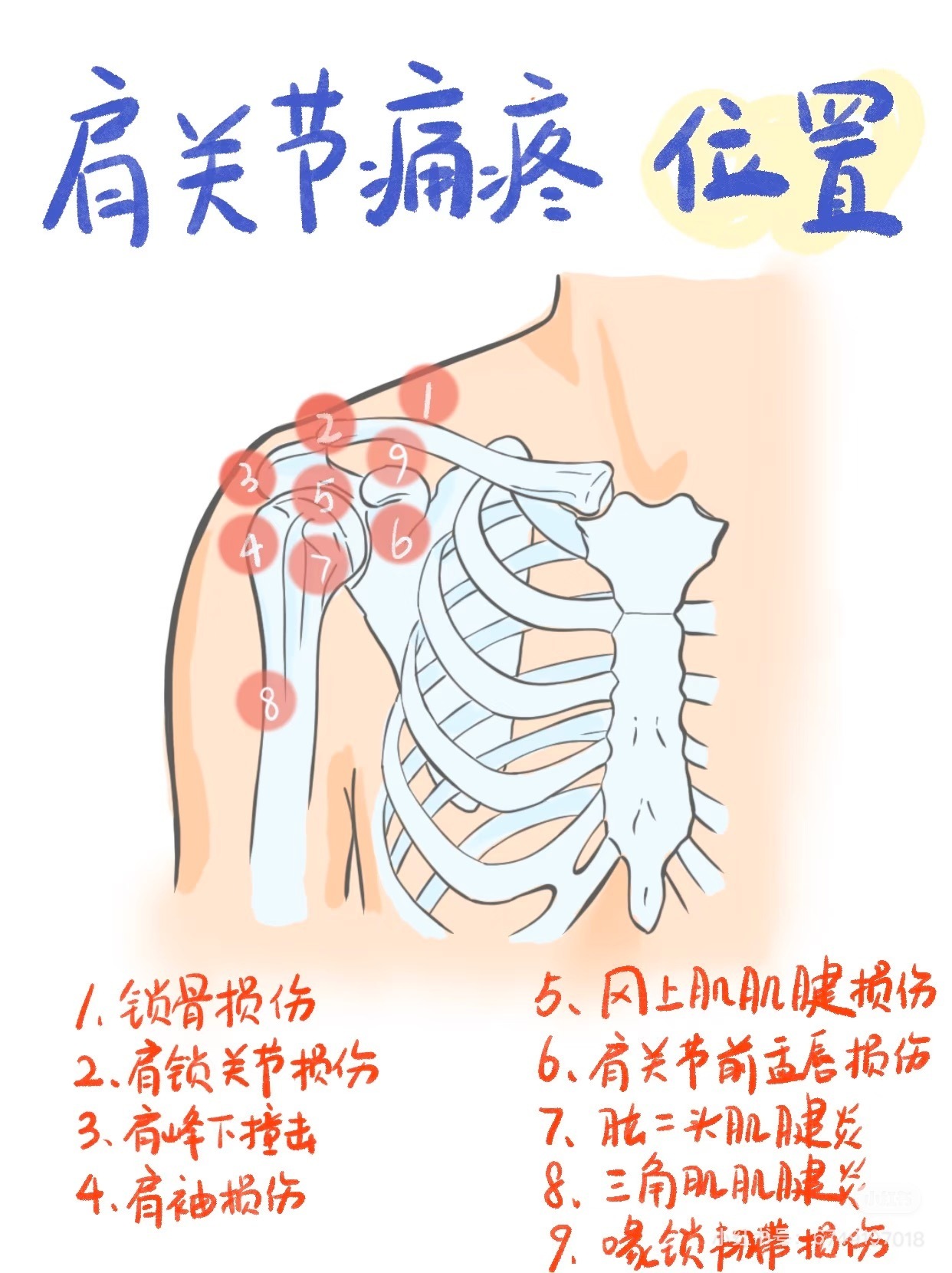 肩膀疼痛除了肩袖损伤，肩关节还有哪些可能的疼痛问题？来看这张图，带你更清楚的认