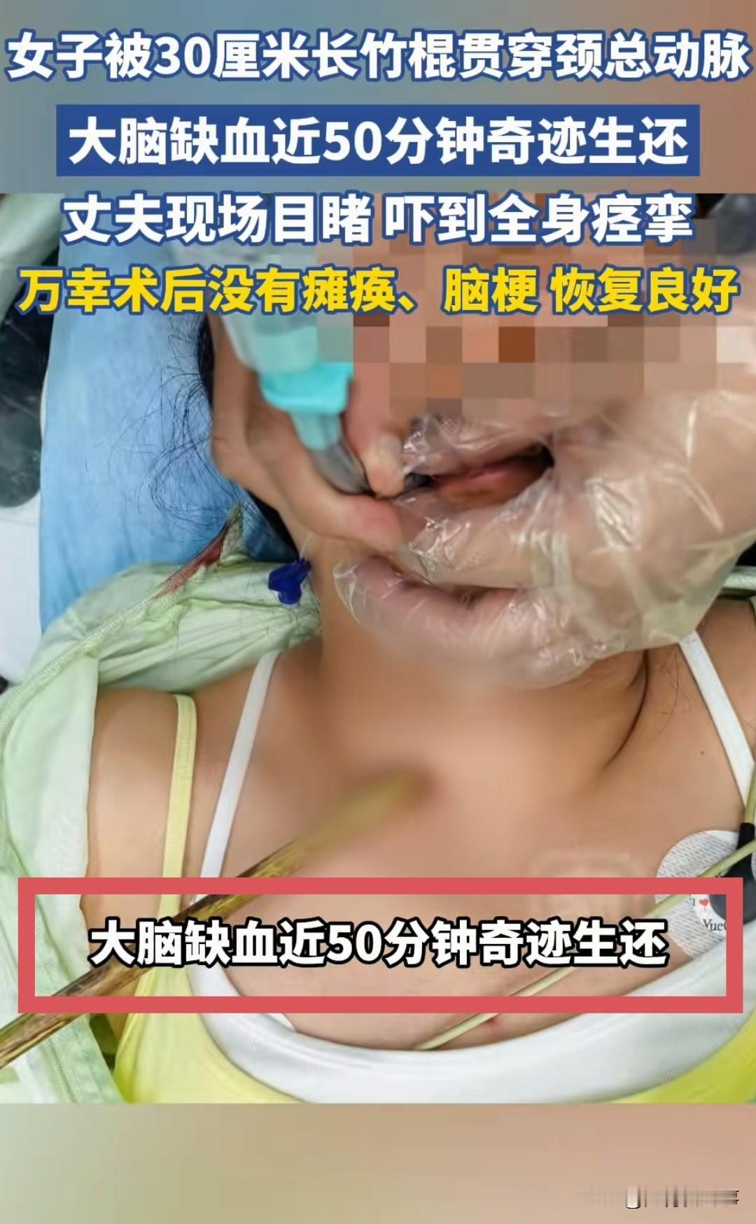 命悬一线！云南保山一条乡间路上，妻子骑车走在前面，突然重重摔倒在地，丈夫冲上去一