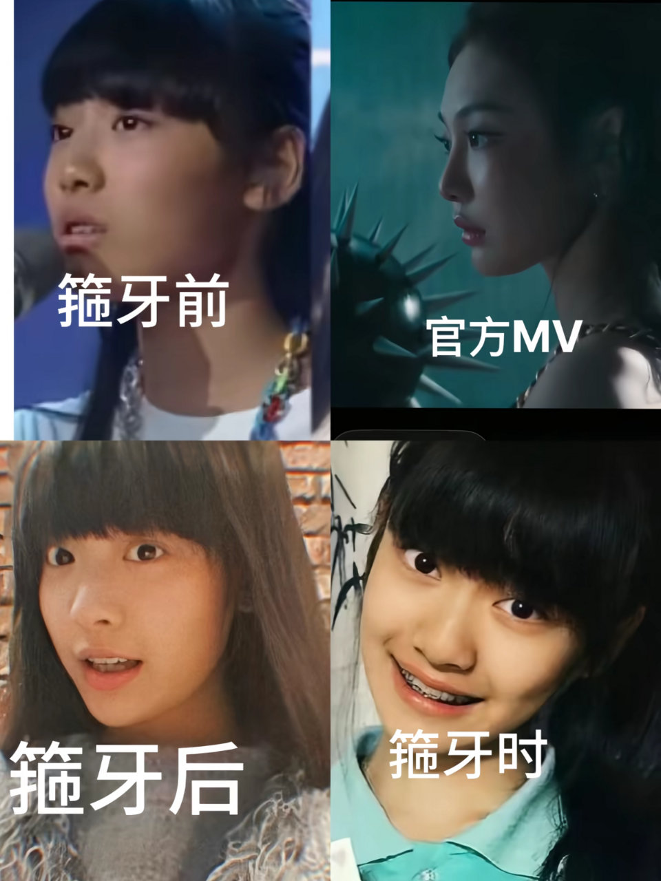 允许箍牙允许变瘦！