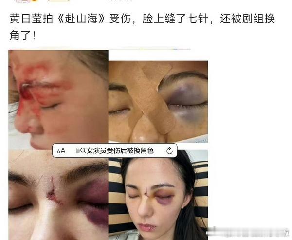原来黄日莹才是原来演赴山海官配角色的那个当时小黄提前进组训练受伤，脸缝了七针，