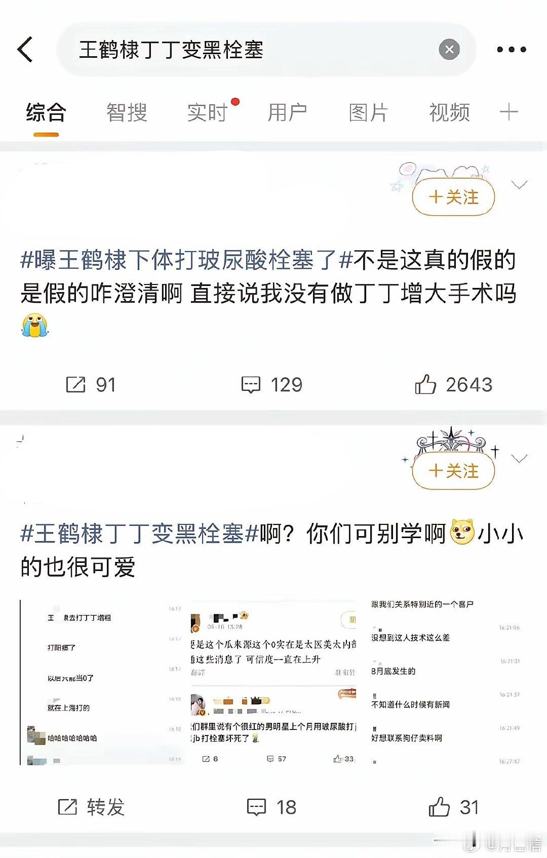 王鹤棣的瓜现在看下来有点假，作为一个当红明星，即使真要做这种手术也不会这么草率