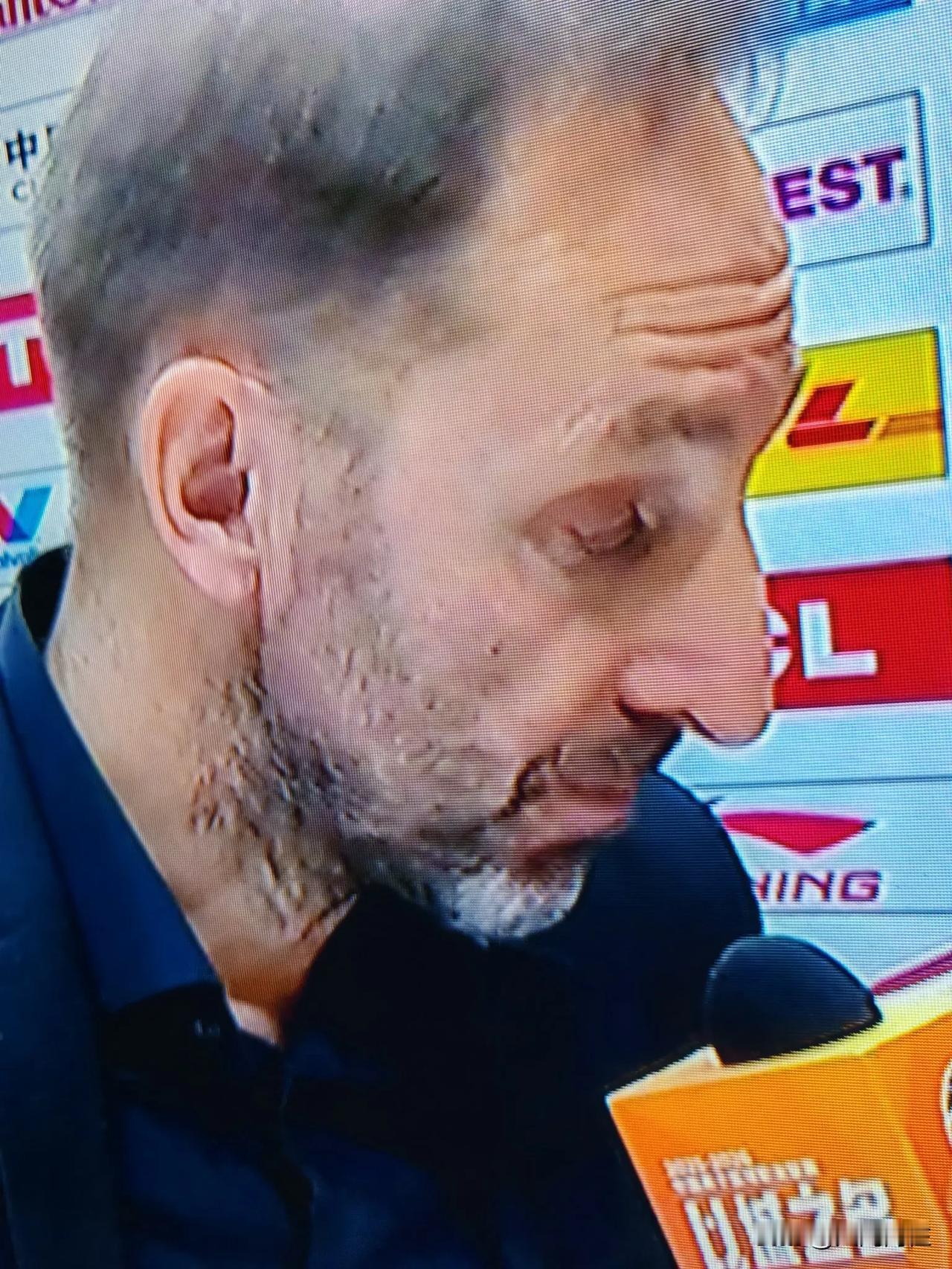 看到浙江稠州力克广东和狂胜广州，很是感慨！怎么换了名外教法莱卡斯变化之大有点惊讶