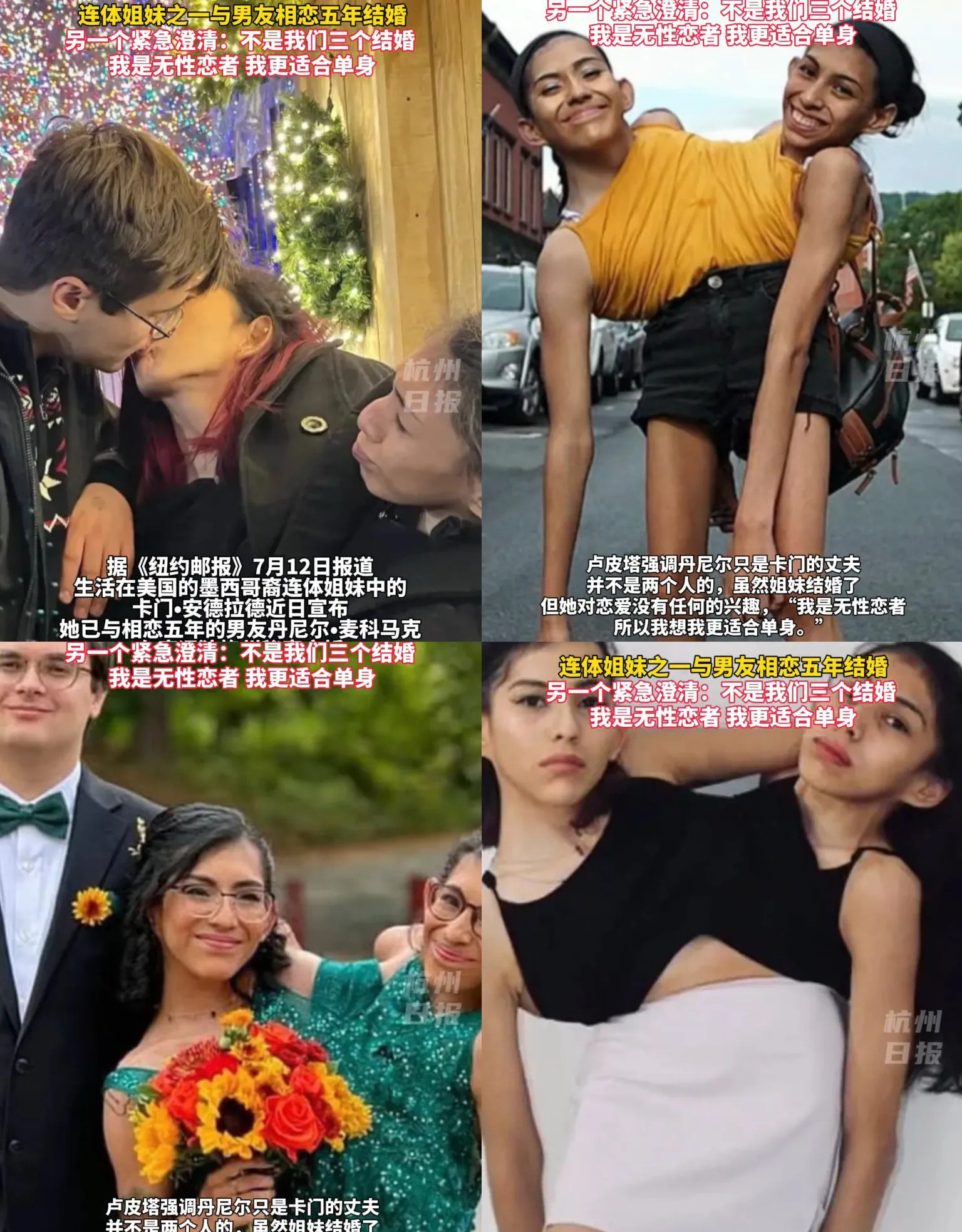 连体姐妹结婚，同房咋办？天呐！连体姐妹竟然结婚了！这可不