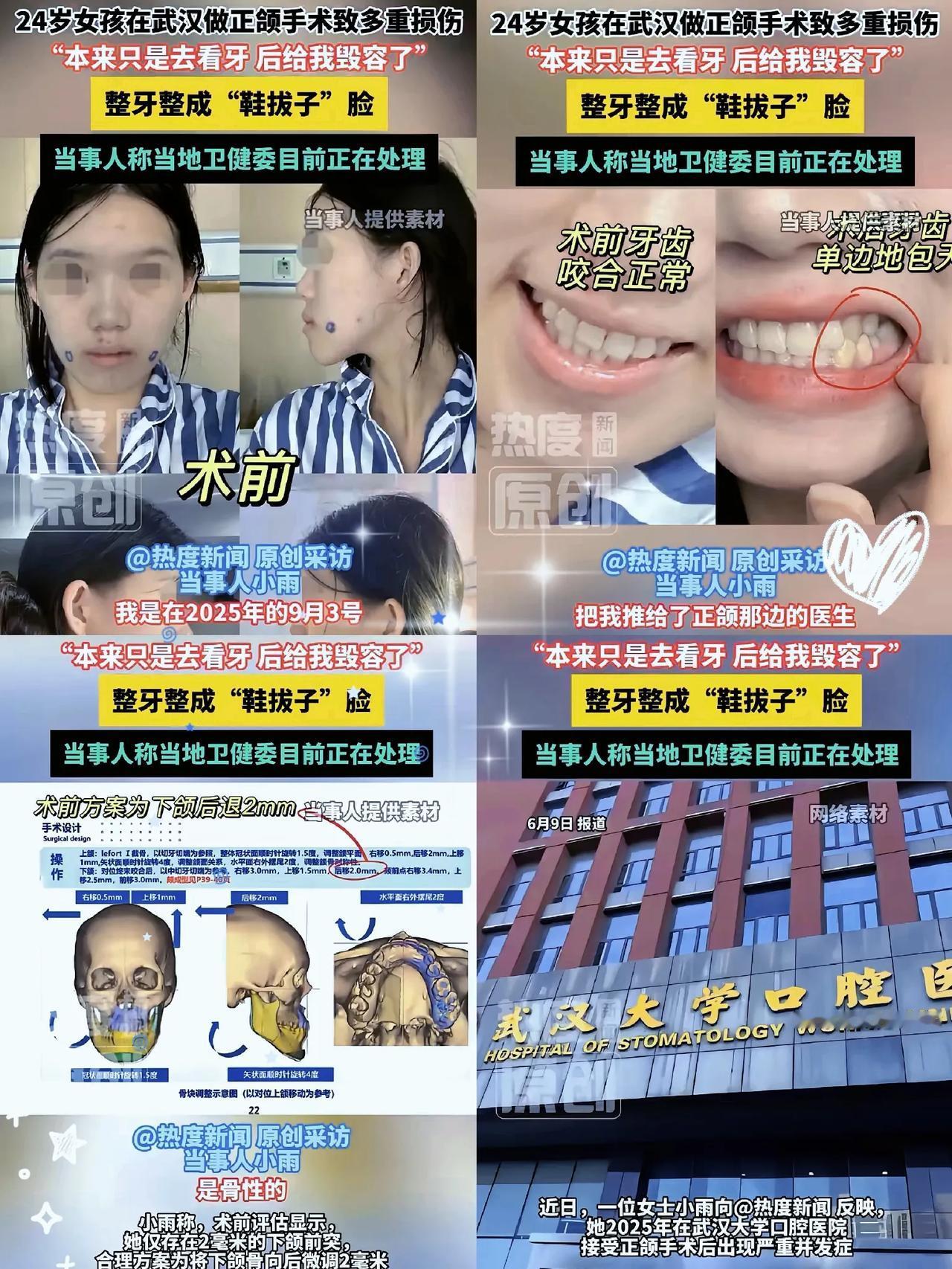 武汉小雨姑娘这遭遇，听着都让人揪心！本想补个牙、整整牙，结果被武大口腔医院医