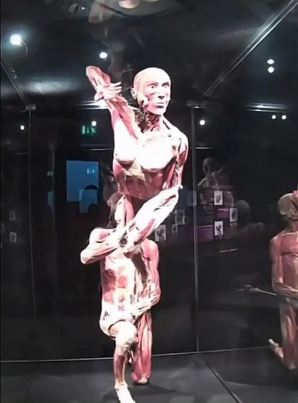 有个特别让人心碎的真实事儿，德国一位母亲去看很火的“人体世界”展览，没想到竟在展