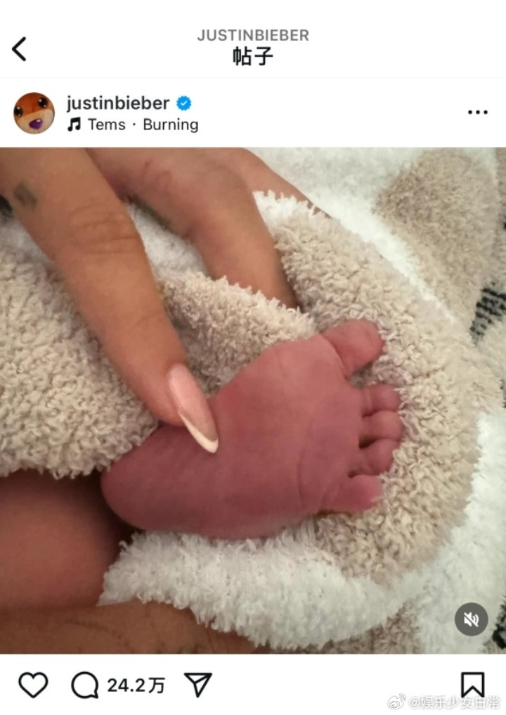 海莉比伯是意外怀孕医生建议暂缓生育，她却意外怀孕，18小时无麻醉引产，产后大出血