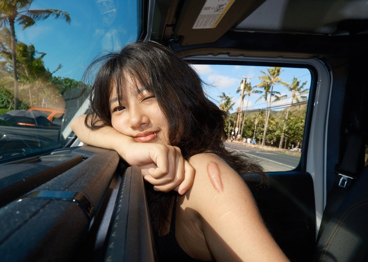 贾静雯大女儿梧桐妹晒度假美照，不过，她手臂上怎么会那么多大大小小的疤痕？爸妈虽然