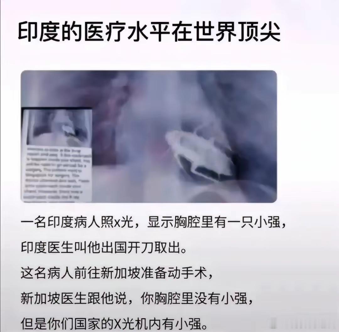 印度人的医疗水平无敌了。一名印度病人照射X光图片，显示胸腔里有一只小强。且不说小