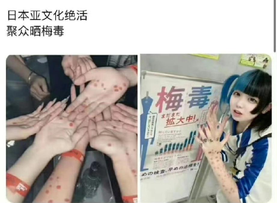 真晦气，怎么和小本子做邻居，幸好中间隔了海，要不然膈应死了！日本梅毒感染