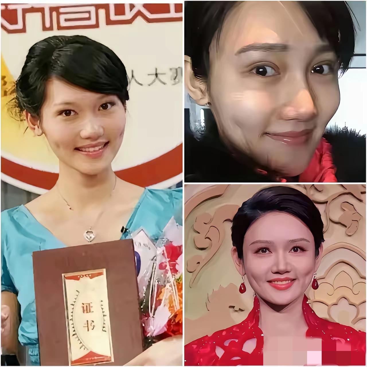 龙洋是不是医美过度了？这么多春晚女主持人里，就她的脸给人感觉怪怪的，看着不像是