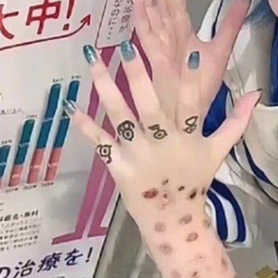 日本年轻人聚众晒梅毒不以为耻，反以为荣。而且还流行亮出自己的梅毒标志性病变，