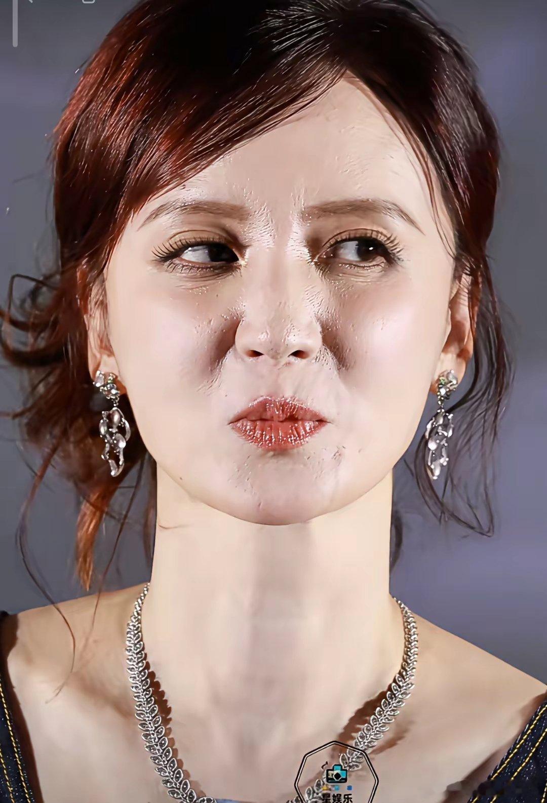 45岁张萌的脸，为什么是这样的?这个鼻子是怎么了？