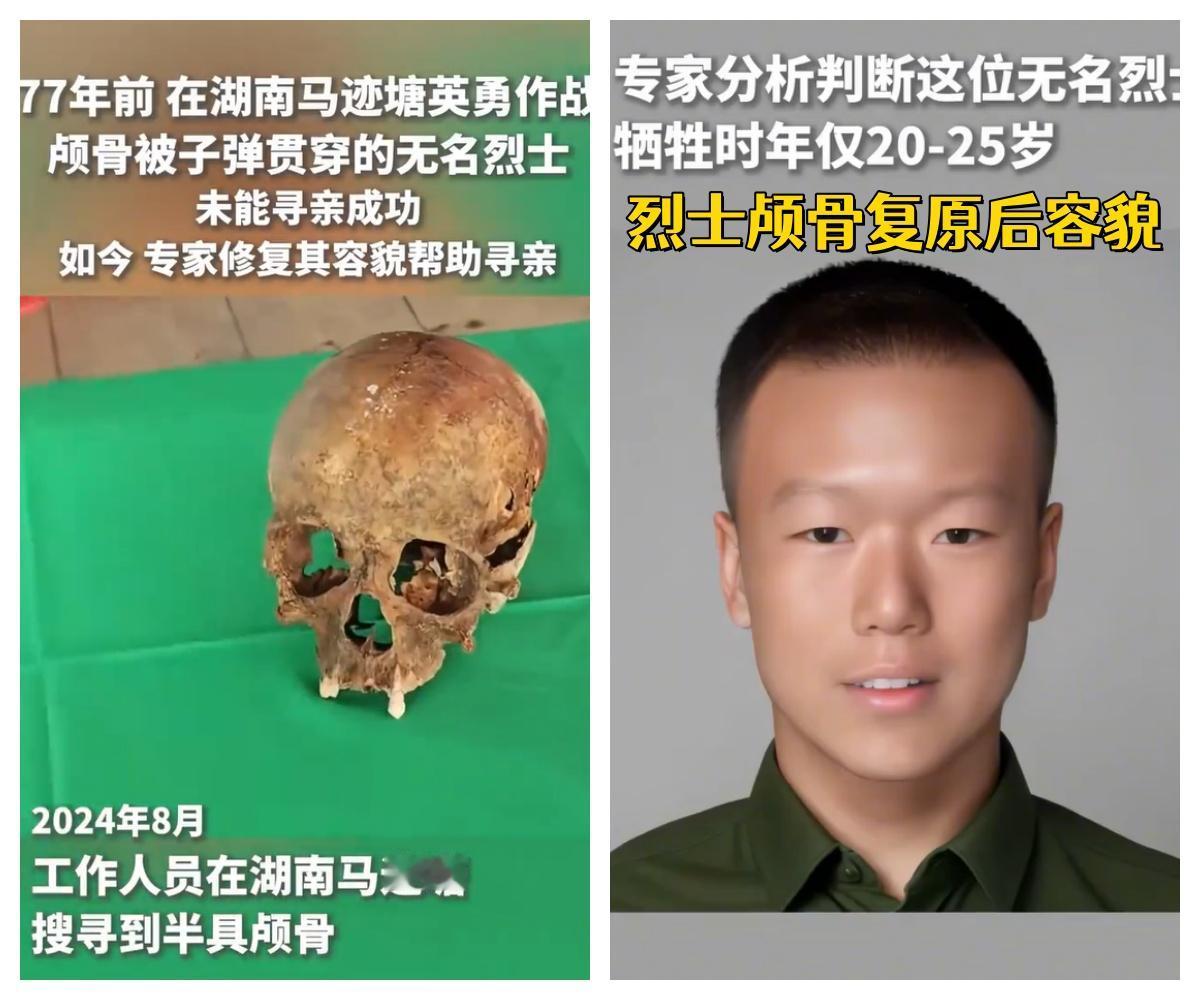 2026年5月初，复旦大学专家通过颅骨复原，成功将一名“无名烈士”样貌复原。他已