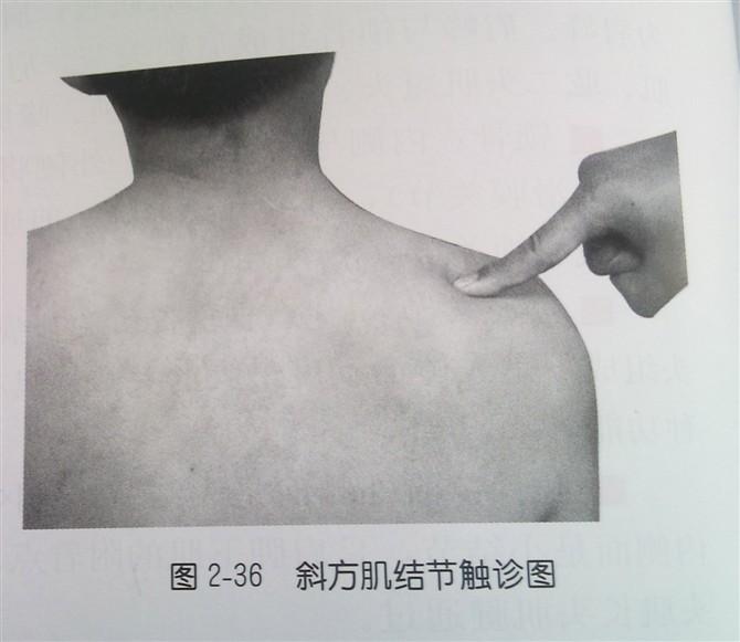 肩部疼痛的触诊图解(很珍贵资料), 值得一看