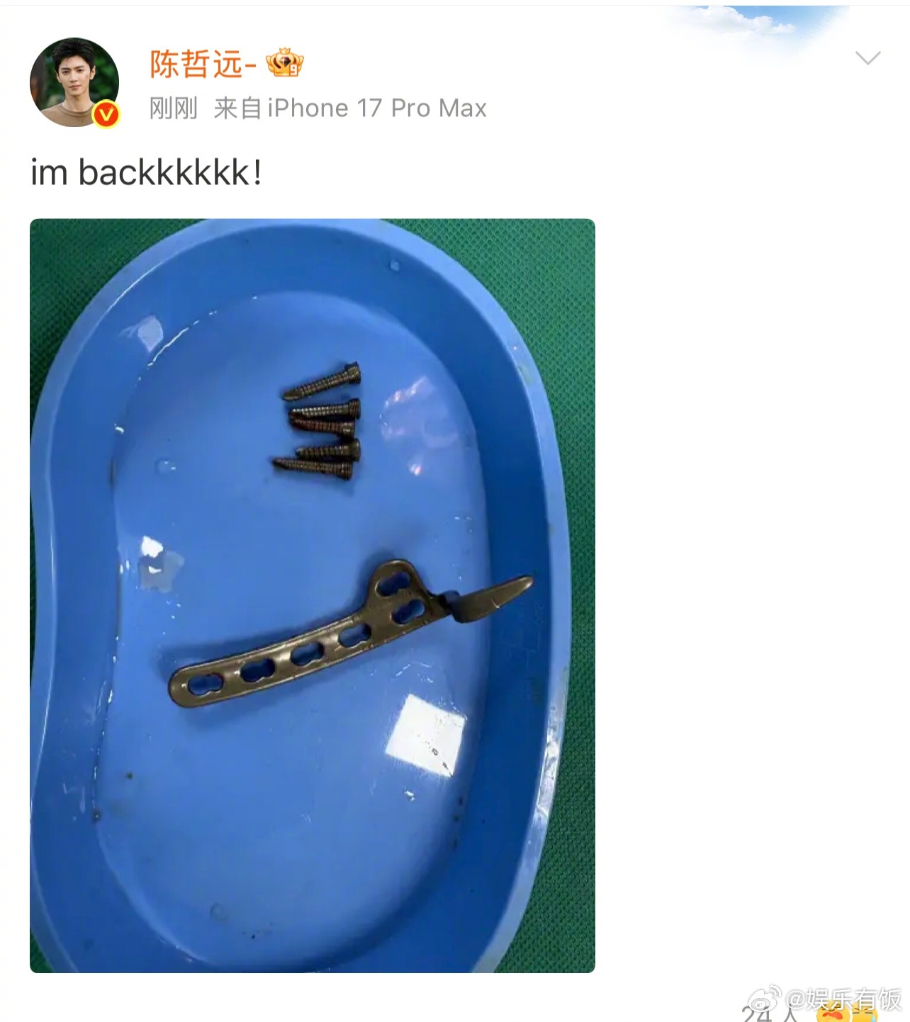 陈哲远做完手术报平安陈哲远做完手术取出5颗钉子呜呜呜哲远做完手术就跟大家报平安