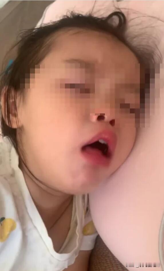 儿科医生的忠告：孩子咳嗽未愈或处于恢复期，别吃任何水果！最近接诊了很多咳嗽