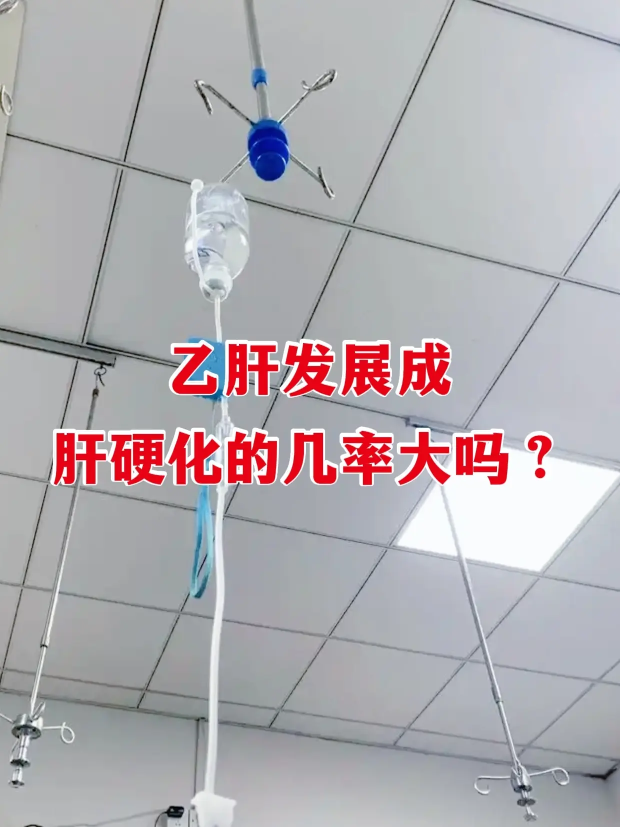 乙肝发展成肝硬化的几率大吗？。很多乙肝朋友都特别焦虑，总觉得查出乙肝就...