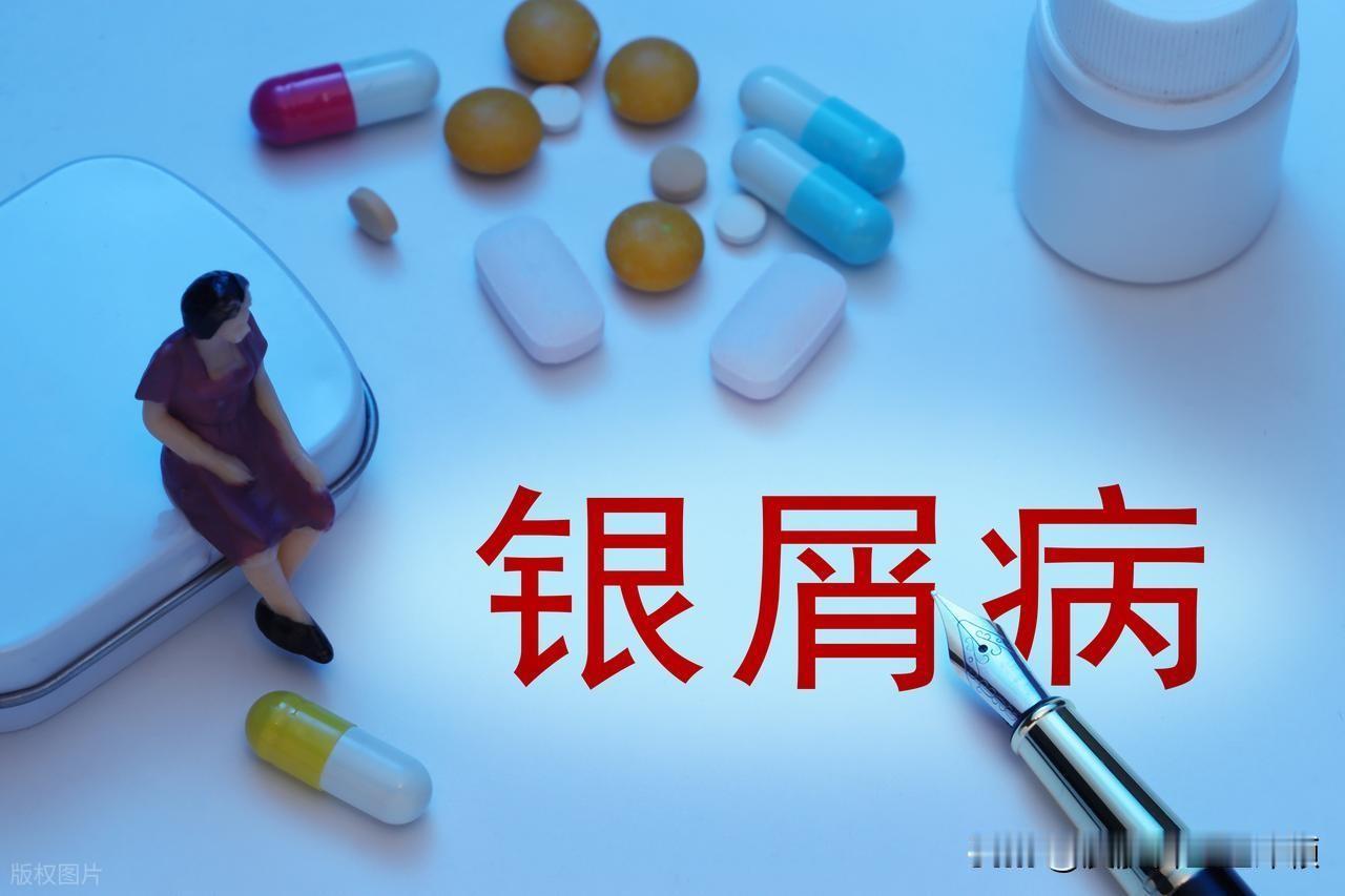 诱发银屑病的因素有哪些?银屑病是一种常见的慢性复发性炎症性皮肤病。银屑病的发