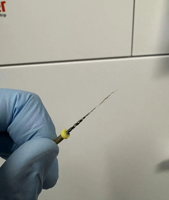 这是什么？这是牙齿上的整根神经