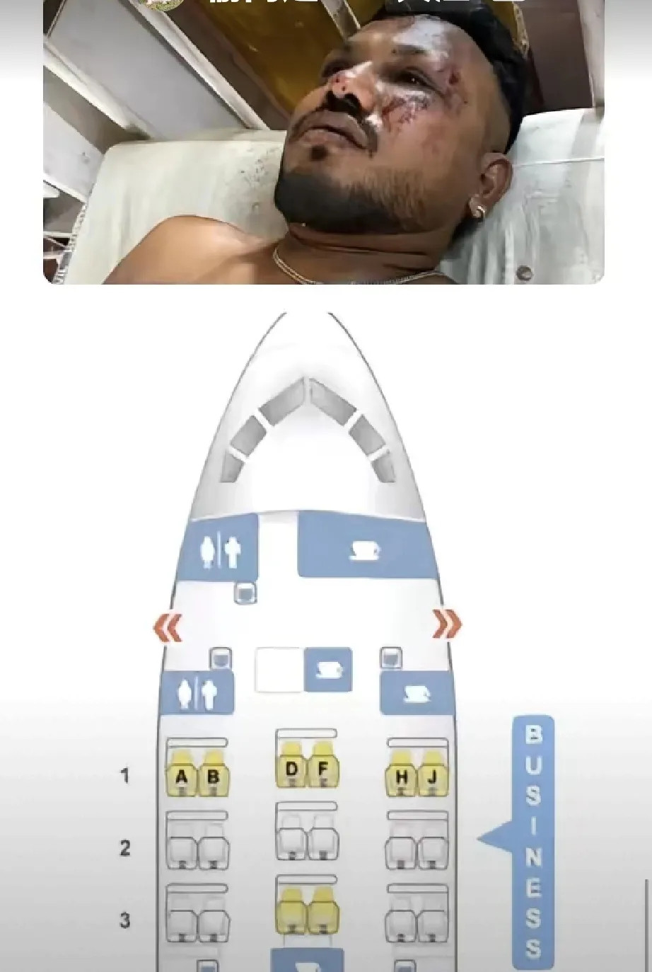 消息终于被证实了，印度坠亡飞机幸存者是40岁的英国男子维什瓦什·库马尔·拉梅什。