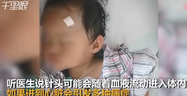 真是太可怕了！云南大理，女子带1岁的孩子去输液，护士在头上给她扎针，1个月后，孩
