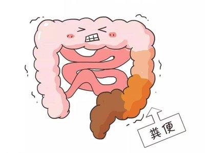 大便粘是湿重，大便干是阴虚，大便细软是气虚，送你三味方，顺畅排便！一、大便粘