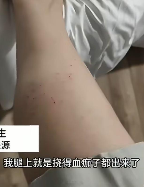 床底藏大量避孕套酒店称阿姨忘了扫天啦，看来下次住酒店还得自己挪开床，看看床底[惊