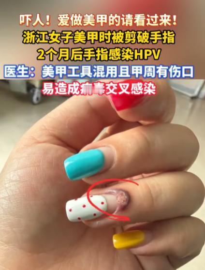 “悲剧还是发生了！”浙江杭州，一女子在美甲店修剪死皮时，被工具剪破手指，当时只喷