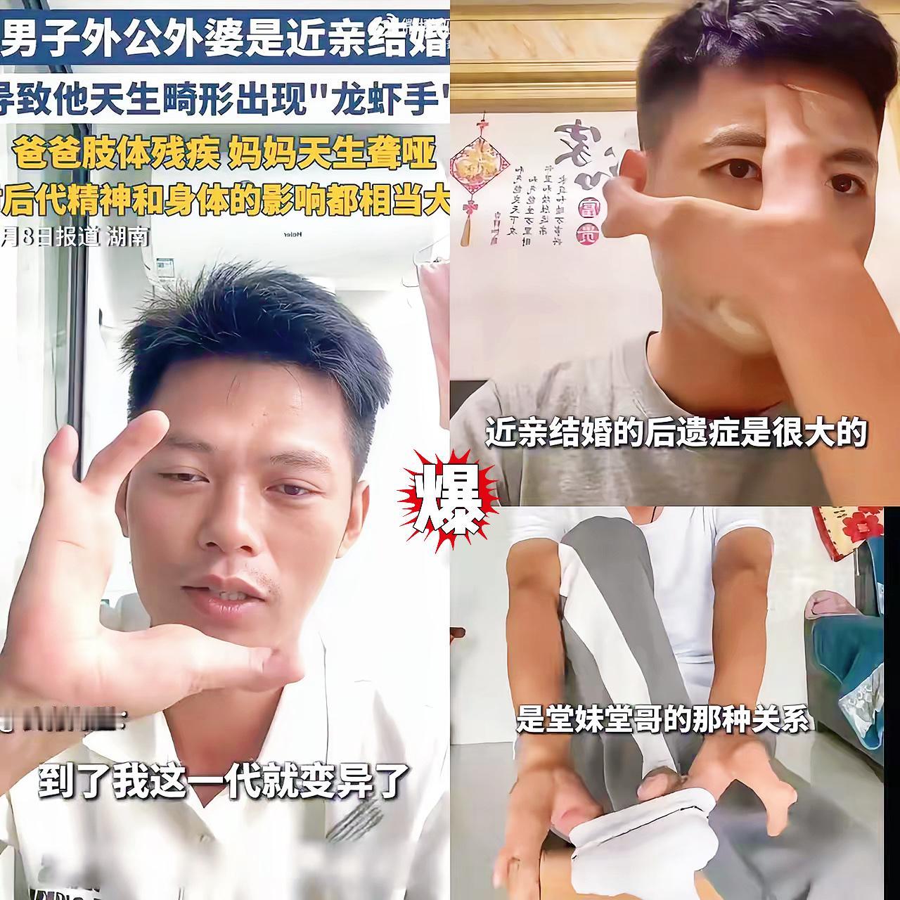 真是疯了​都这样了还要结婚生子！90后小伙因为外公外婆是亲堂兄妹，家族三代全