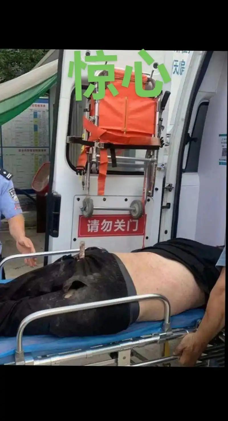 工地事故有一种疼叫做看着都疼