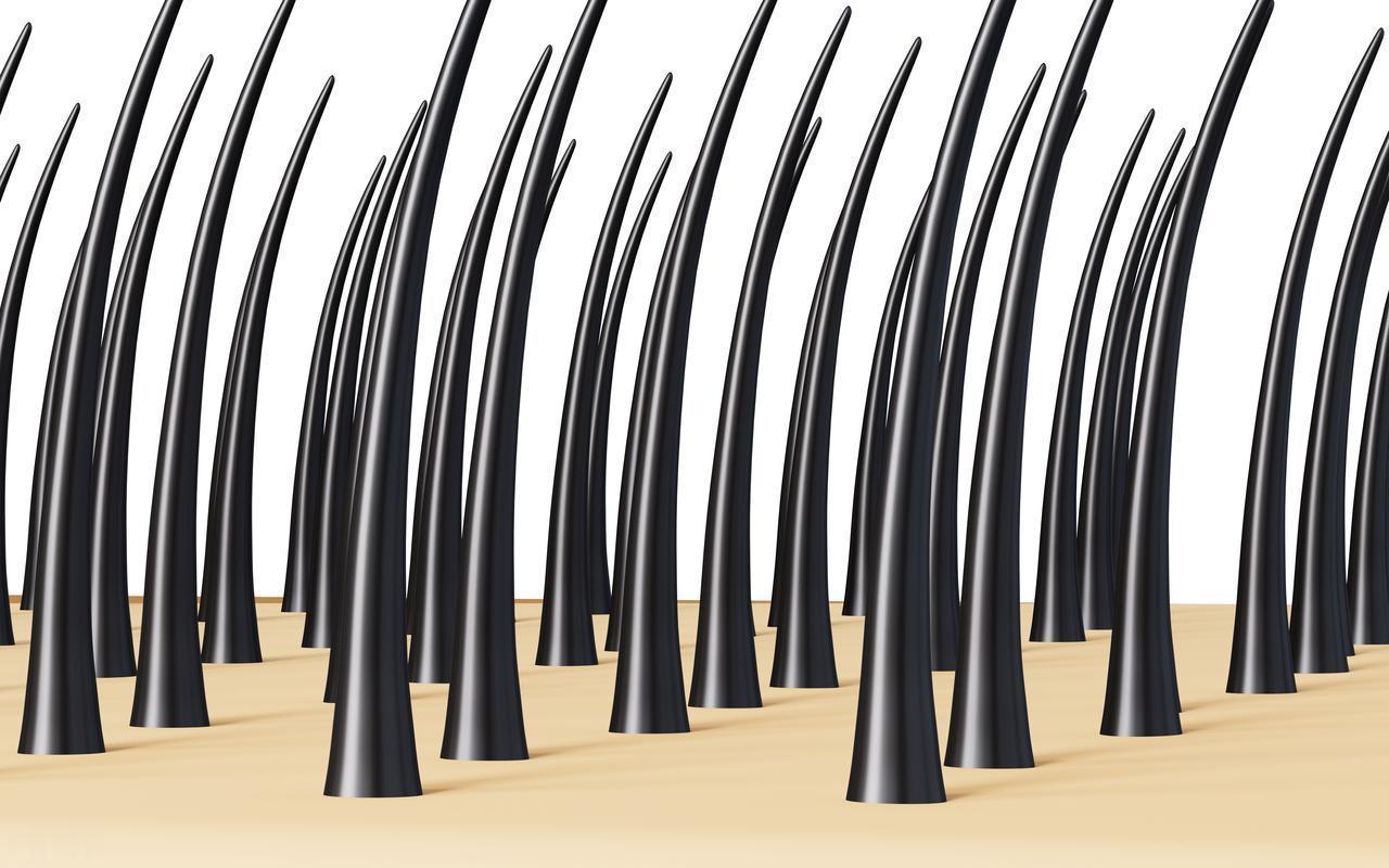 有些女性下身无毛是怎么回事？这4个原因，为了健康，最好了解有些女性发现自己下