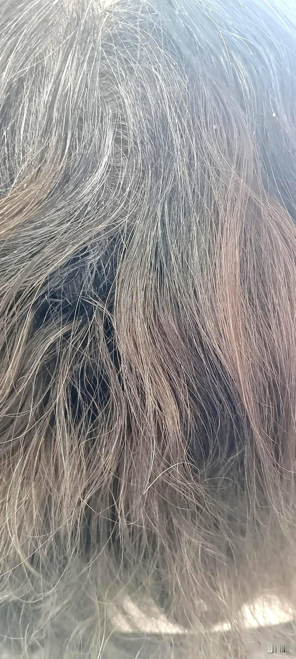 有没有白发转黑发的方法?有的71年头发大概白了70%。最近开始用木梳早晚