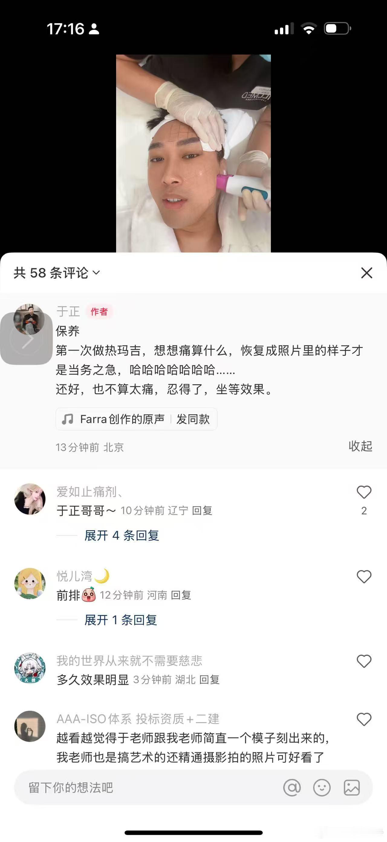 热玛吉怎么没把于老登痛死[微笑]​​​