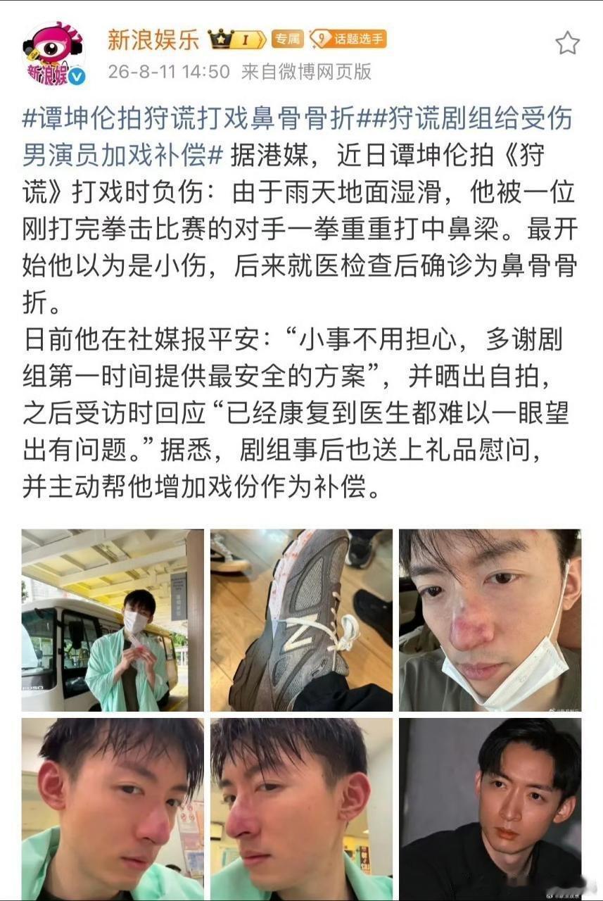 谭坤伦拍狩谎打戏鼻骨骨折前段时间卫诗雅也受伤了