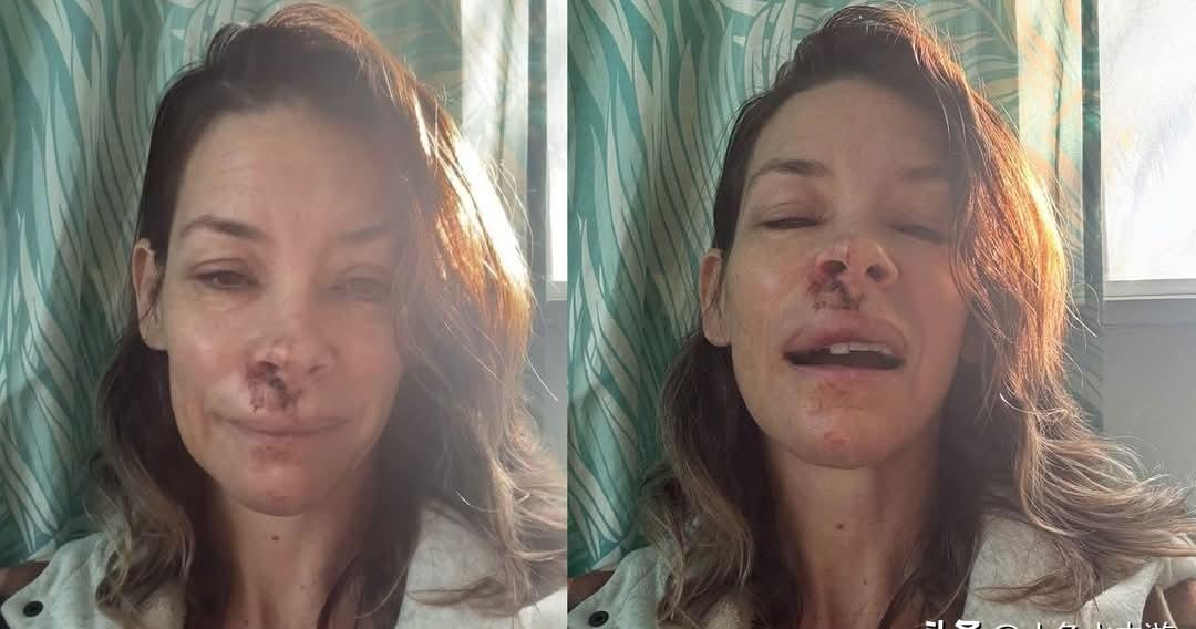 沙滩散步第3分钟，她突然眼前一黑。后脑勺径直砸向礁石的尖锐棱角——这不是电影特