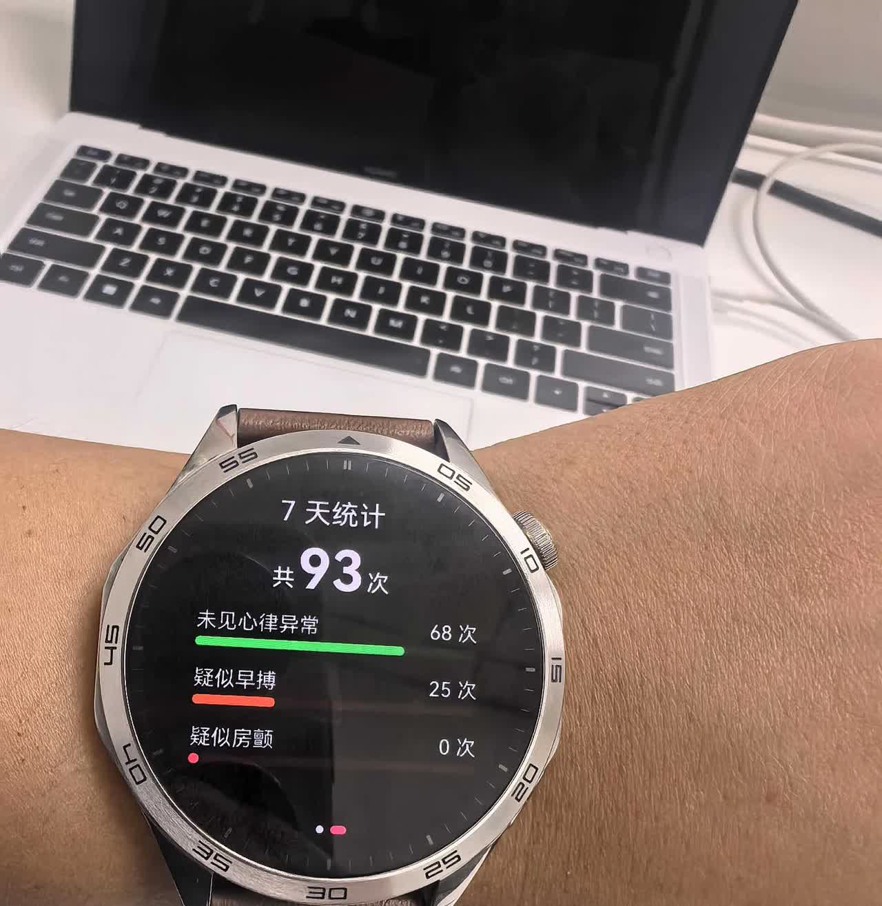华为智能手表，提示疑似早博。据说华为的智能手表检测就相当于中医把脉！这个疑似早博