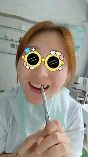 自己给自己拔牙，这是个狠人儿啊[捂脸哭]
