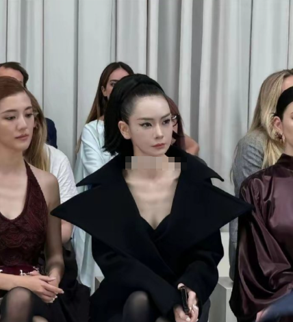 拉皮手术，脸虽然紧了，但是表情真的还自然吗？​​​