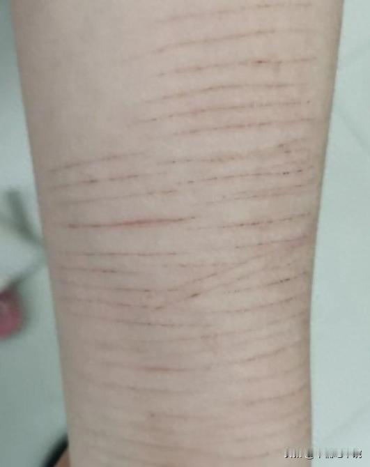 4月24日，郑州14岁女生胳膊上满是划痕，老师坚持让家长带去看病，家长却表示，她