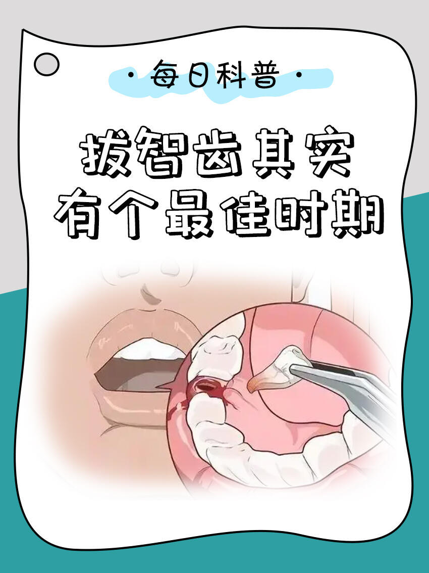 口腔科口腔护理别等疼起来了才想起来要拔一般来说，13～30岁是拔智齿的最佳时期。