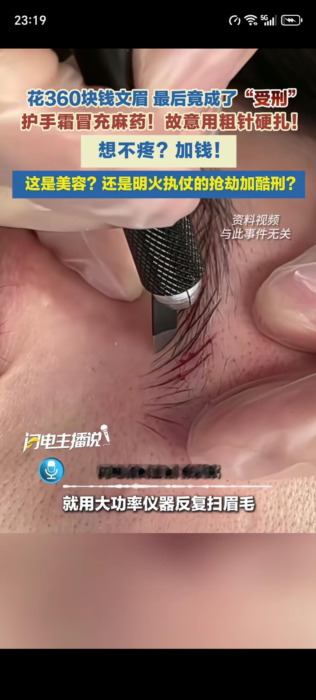 上海的李女士被360元纹眉吸引了，结果麻药是用护手霜冒充的，纹眉是用粗针头故意扎