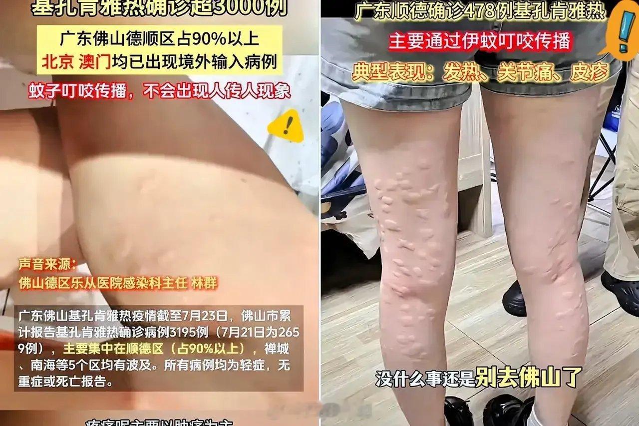 基孔肯雅热这种病毒，第一次听说我国第一次爆发这真的是极其罕见划重点，第一次爆发