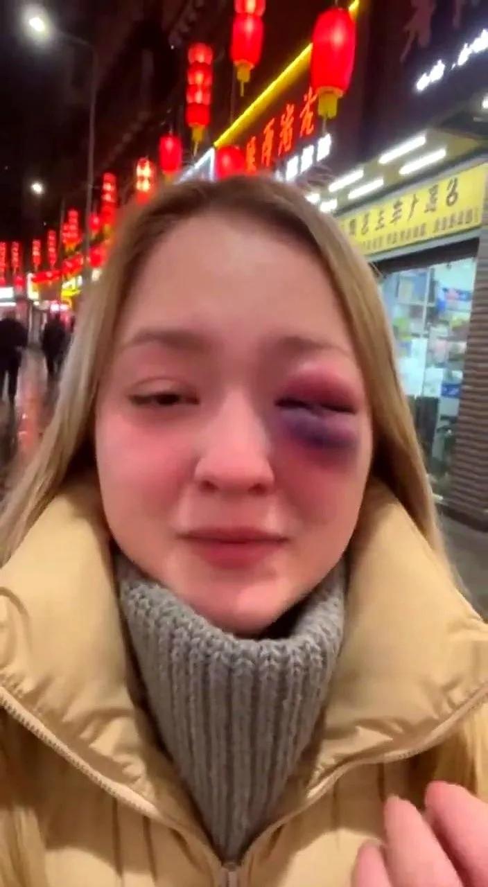 一个来自俄罗斯的姑娘顶着青紫的右眼，拖着一只登机箱落在哈尔滨机场的深夜，说自己受